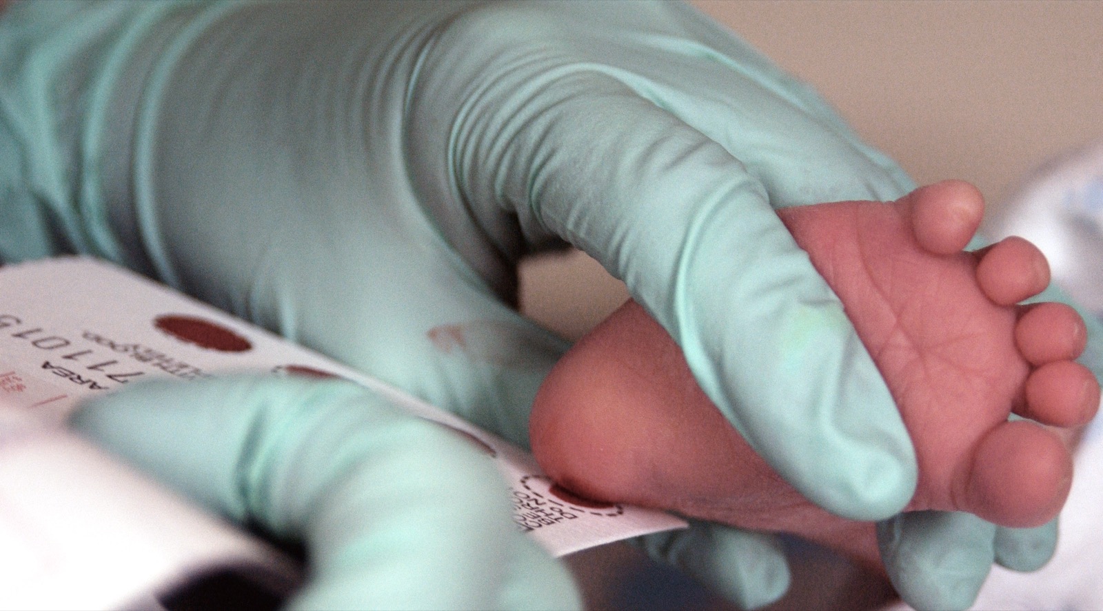 A gloved hand holds a two-week-old baby's heel while drops of blood are collected on a newborn screening card.
